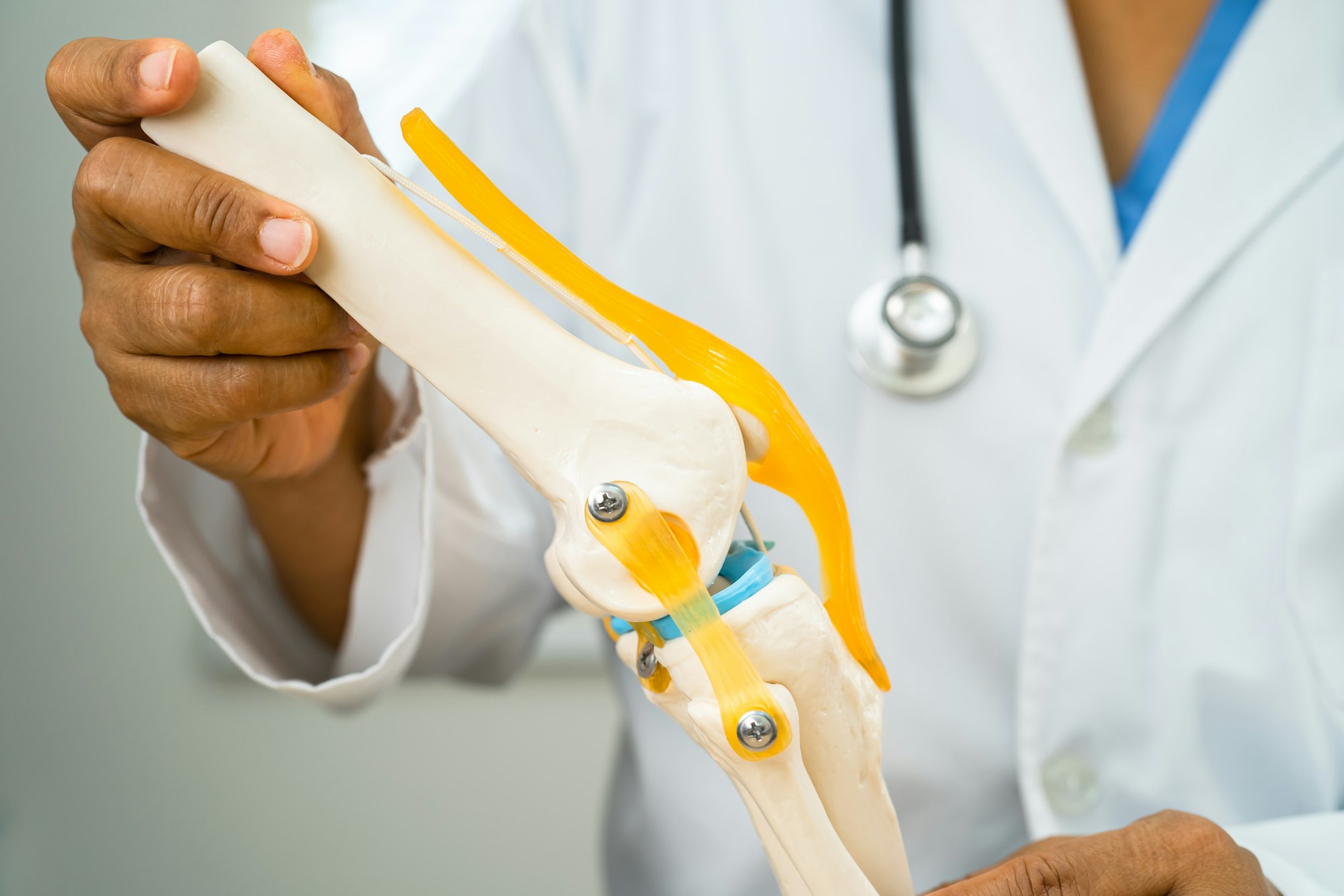 Osteoarthritis of the knee, Doctor holding human knee joint orthopedic anatomy model in hospital.